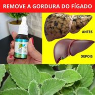 Figadozen Apenas 20 Gotas para Varrer a Gordura no Figado