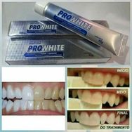 Gel Dental(branquear Os Dentes)