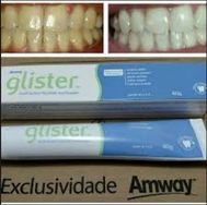 Clareamento Dental Anway