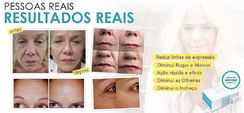 Instantly Ageless