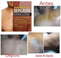 Depilação e Massagem em Itaguai