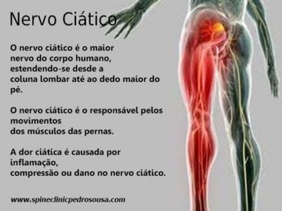 Dor Nervo Ciático - Massagem - Centro - São José SC