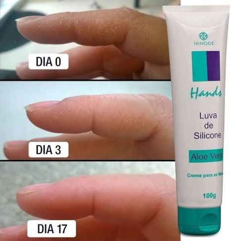 Hands Luva de Silicone com Aloe Vera
