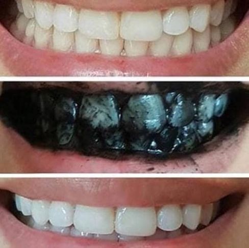 Carvão Ativado Orgânico – Clareador dos Dentes + Detox Bucal