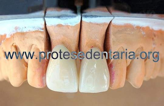 Prótese Dentária Consertos Dentadura, Roach, Prótese Parcial